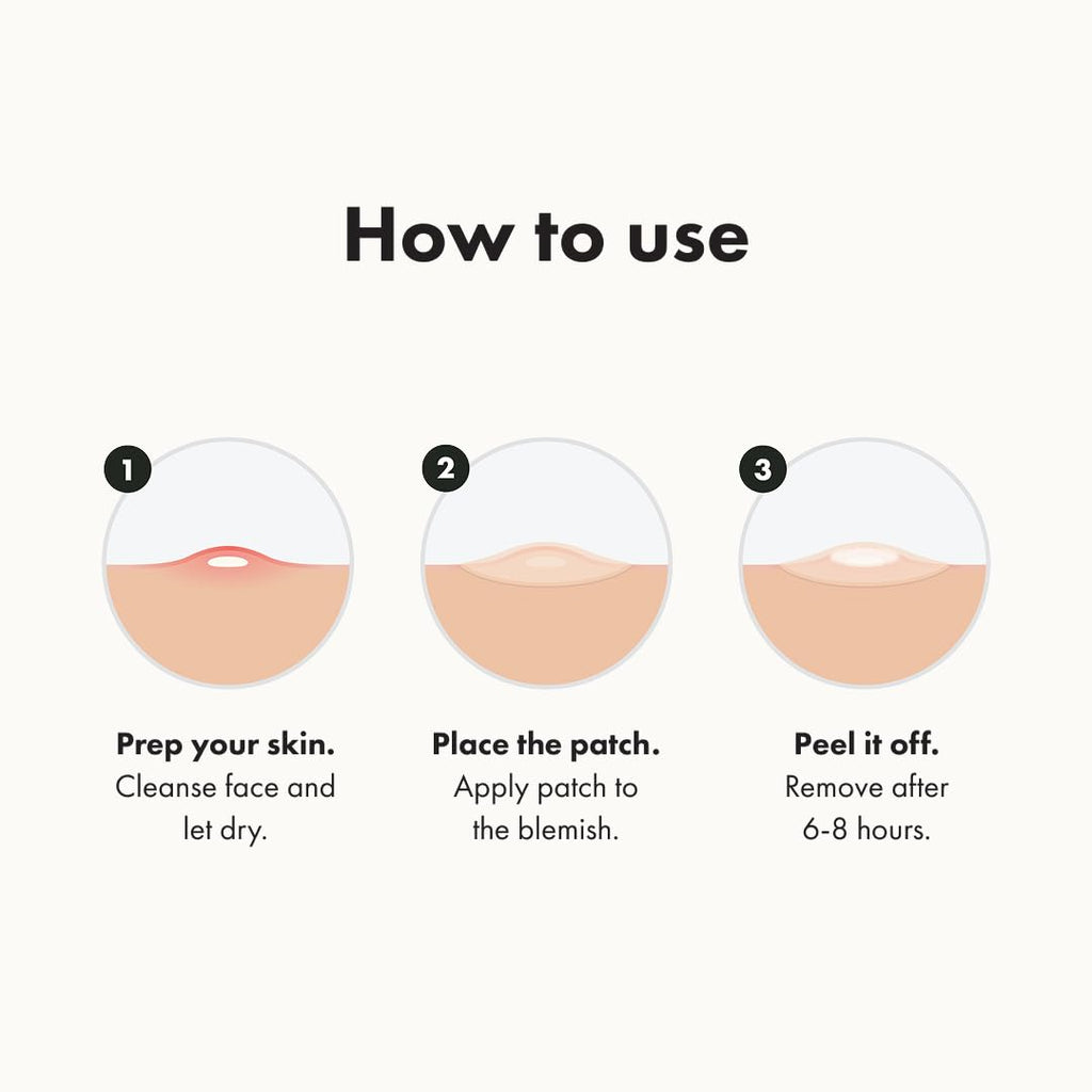 Mighty Patch Acne Patches – Fast-Acting Hydrocolloid Spot Treatment