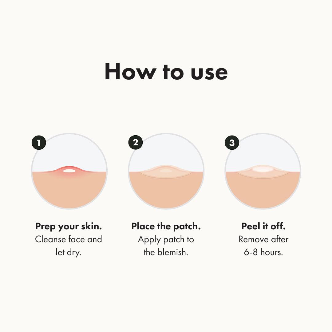Mighty Patch Acne Patches – Fast-Acting Hydrocolloid Spot Treatment